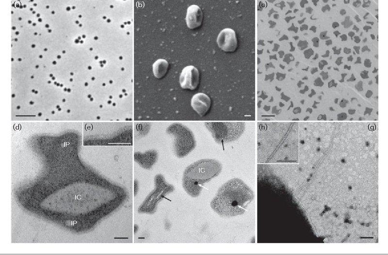 Nitrososphaera Viennensis A New Species Genus Family Order And Class Of Soil Dwelling Archaea